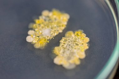植物elisa試劑盒實驗原理與產(chǎn)品說明簡介 植物elisa試劑盒實驗原理與產(chǎn)品說明簡介