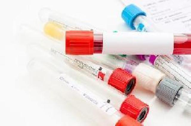 促性腺激素釋放激素檢測(cè)